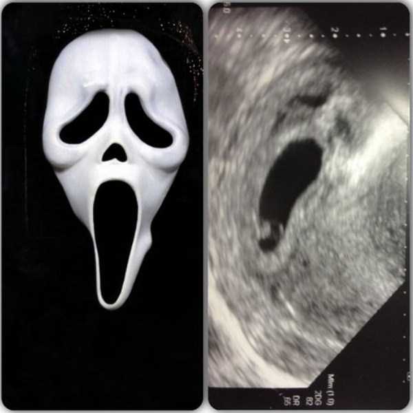 funny-ultrasound-photos-14