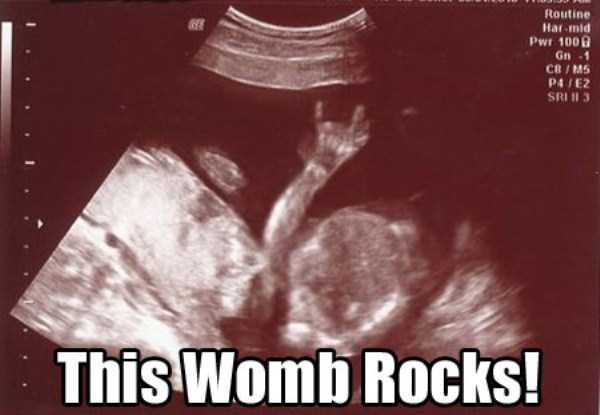 funny-ultrasound-photos-16