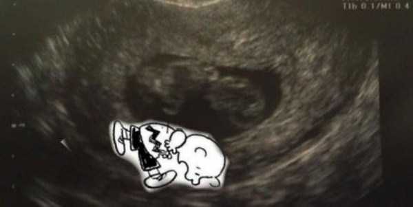 funny-ultrasound-photos-5