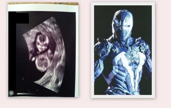 funny-ultrasound-photos-9